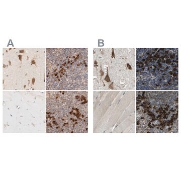 Anti-SYVN1 antibody produced in rabbit Prestige Antibodies&#174; Powered by Atlas Antibodies, affinity isolated antibody, buffered aqueous glycerol solution