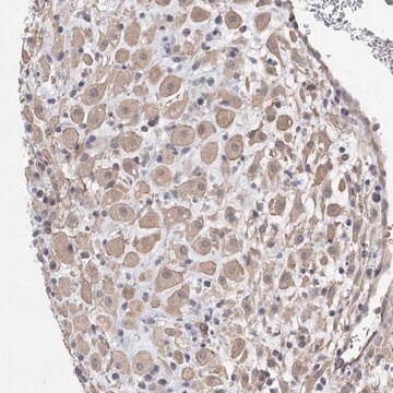 Anti-AOC1 antibody produced in rabbit Prestige Antibodies&#174; Powered by Atlas Antibodies, affinity isolated antibody, buffered aqueous glycerol solution