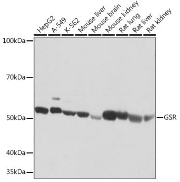 Anti-GSR Antibody, clone 2J5N9, Rabbit Monoclonal