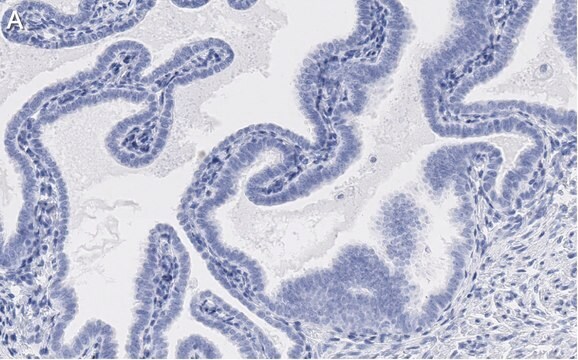 Anti-SOX17 Antibody, clone 3F7, ZooMAb&#174; Rabbit Monoclonal recombinant, expressed in HEK 293 cells