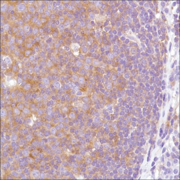 Anti-VPAC2 antibody, Rabbit monoclonal recombinant, expressed in proprietary host, clone SP235, affinity isolated antibody