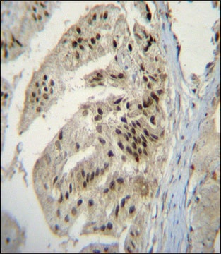 ANTI-PAP (CENTER) antibody produced in rabbit IgG fraction of antiserum, buffered aqueous solution