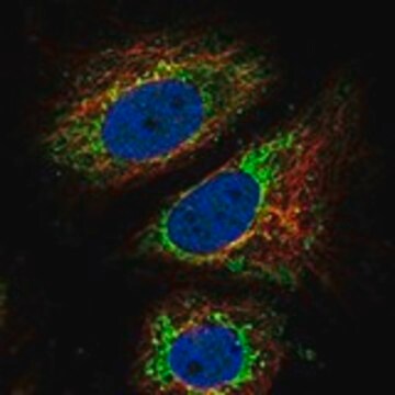 Anti-ARID4B antibody produced in rabbit Prestige Antibodies&#174; Powered by Atlas Antibodies, affinity isolated antibody, buffered aqueous glycerol solution