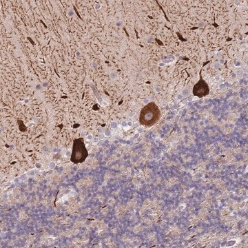 Anti-ANKRD10 antibody produced in rabbit Prestige Antibodies&#174; Powered by Atlas Antibodies, affinity isolated antibody, buffered aqueous glycerol solution