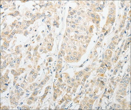 Anti-AGBL1 antibody produced in rabbit affinity isolated antibody