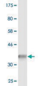 PMP22 monoclonal antibody Immunohistochemistry, Western, ELISA ...