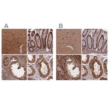 Anti-NAE1 antibody produced in rabbit Prestige Antibodies&#174; Powered by Atlas Antibodies, affinity isolated antibody, buffered aqueous glycerol solution