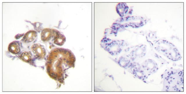 Anti-ETK antibody produced in rabbit affinity isolated antibody