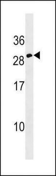 ANTI-ERYTHROPOIETIN(C-TERMINAL) antibody produced in rabbit IgG fraction of antiserum, buffered aqueous solution