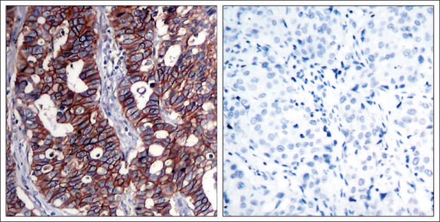 Anti-ERBB2 (Ab-1221/1222) antibody produced in rabbit affinity isolated antibody