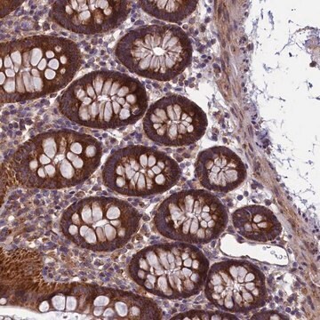 Anti-ACAD8 antibody produced in rabbit Prestige Antibodies&#174; Powered by Atlas Antibodies, affinity isolated antibody, buffered aqueous glycerol solution