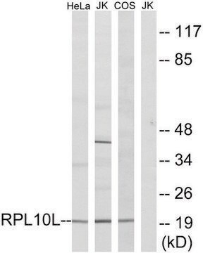 Anti-RPL10L antibody produced in rabbit affinity isolated antibody