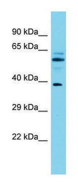 Anti-MACROD1 (N-terminal) antibody produced in rabbit affinity isolated antibody