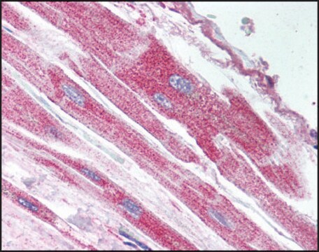 Anti-USP18 antibody produced in rabbit affinity isolated antibody, buffered aqueous solution