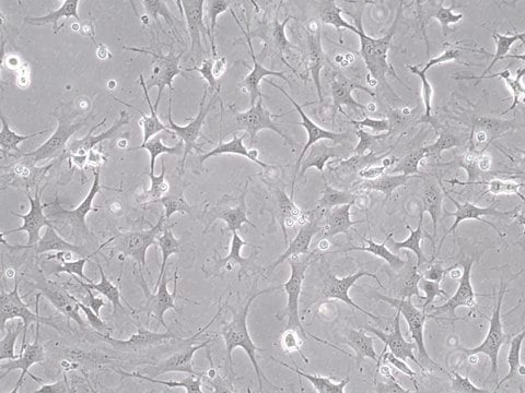 Mouse OP9-DL4 Delta-like 4 Notch Ligand Cell Line