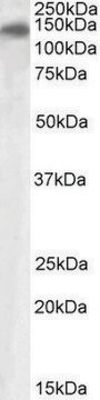 Anti-PLA2R1 antibody produced in goat affinity isolated antibody, buffered aqueous solution