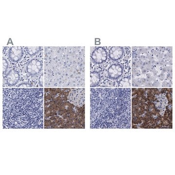 Anti-ARSG antibody produced in rabbit Prestige Antibodies&#174; Powered by Atlas Antibodies, affinity isolated antibody, buffered aqueous glycerol solution, Ab2