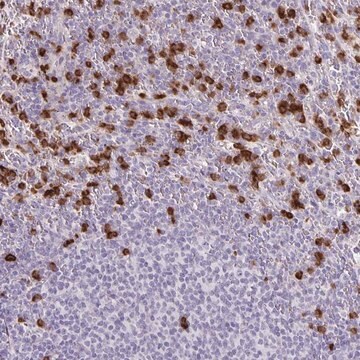 Anti-ADCK1 antibody produced in rabbit Prestige Antibodies&#174; Powered by Atlas Antibodies, affinity isolated antibody, buffered aqueous glycerol solution