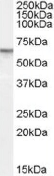 Anti-PDE11A antibody produced in goat affinity isolated antibody, buffered aqueous solution