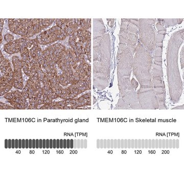 Anti-TMEM106C antibody produced in rabbit Prestige Antibodies&#174; Powered by Atlas Antibodies, affinity isolated antibody, buffered aqueous glycerol solution