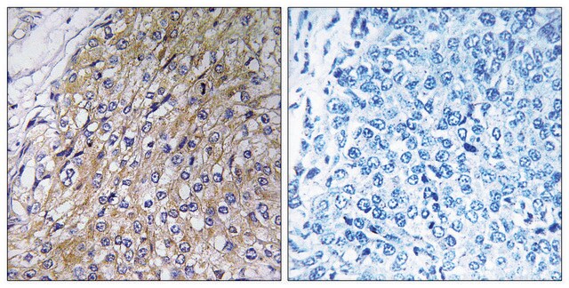 Anti-GOLT1A antibody produced in rabbit affinity isolated antibody