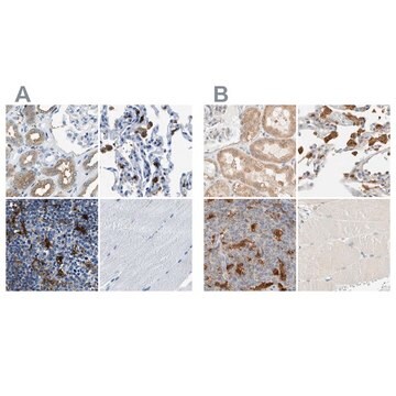 Anti-CAPG antibody produced in rabbit Prestige Antibodies&#174; Powered by Atlas Antibodies, affinity isolated antibody, buffered aqueous glycerol solution, Ab3