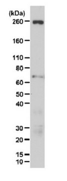 Anti-ARID1B Antibody from rabbit, purified by affinity chromatography