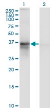 Monoclonal Anti-RP2 antibody produced in mouse clone 5C10, purified immunoglobulin, buffered aqueous solution