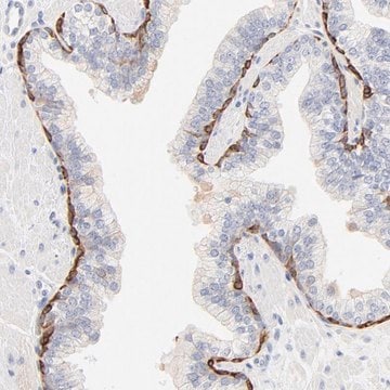 Anti-SLC7A3 antibody produced in rabbit Prestige Antibodies&#174; Powered by Atlas Antibodies, affinity isolated antibody, buffered aqueous glycerol solution