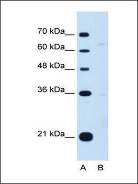 Anti-DONSON antibody produced in rabbit affinity isolated antibody