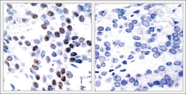 Anti-JUN (Ab-93) antibody produced in rabbit affinity isolated antibody