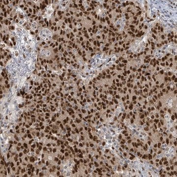 Anti-KLF3 antibody produced in rabbit Prestige Antibodies&#174; Powered by Atlas Antibodies, affinity isolated antibody, buffered aqueous glycerol solution