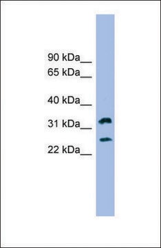 Anti-FCER1A, (N-terminal) antibody produced in rabbit affinity isolated antibody