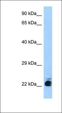 Anti-SLC31A1 antibody produced in rabbit affinity isolated antibody