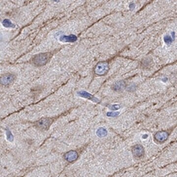 Anti-CAMK2N2 antibody produced in rabbit Prestige Antibodies&#174; Powered by Atlas Antibodies, affinity isolated antibody, buffered aqueous glycerol solution