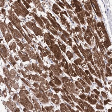 Anti-COX15 antibody produced in rabbit Prestige Antibodies&#174; Powered by Atlas Antibodies, affinity isolated antibody, buffered aqueous glycerol solution