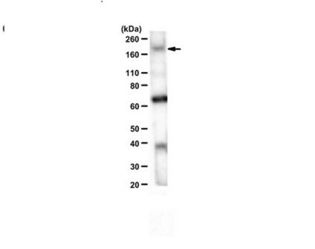 Anticorps anti-CDK13 from rabbit