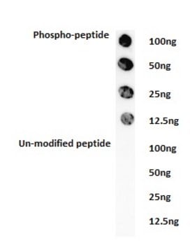 Anti-phospho-ACK1 (Tyr284) Antibody Upstate&#174;, from rabbit