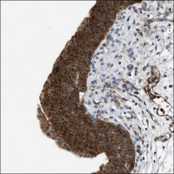 Anti-OBSCN antibody produced in rabbit Prestige Antibodies&#174; Powered by Atlas Antibodies, affinity isolated antibody, buffered aqueous glycerol solution, Ab1