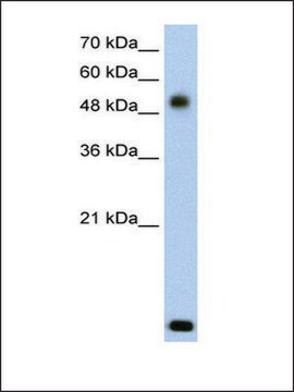 Anti-RSAD2 (AB1) antibody produced in rabbit IgG fraction of antiserum