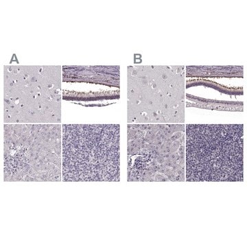 Anti-RP1L1 antibody produced in rabbit Prestige Antibodies&#174; Powered by Atlas Antibodies, affinity isolated antibody