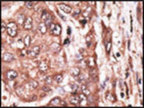 Anti-SHFM3 (C-term) antibody produced in rabbit IgG fraction of antiserum, buffered aqueous solution