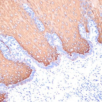 Anti-Cytokeratin 6 (KRT6) Antibody, clone 3F7A1, Rabbit Monoclonal