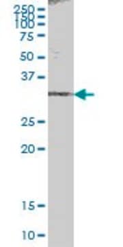 Anti-ACBD6 antibody produced in mouse IgG fraction of antiserum, buffered aqueous solution