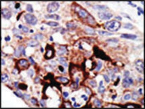 Anti-RAD23B (N-term) antibody produced in rabbit IgG fraction of antiserum, buffered aqueous solution