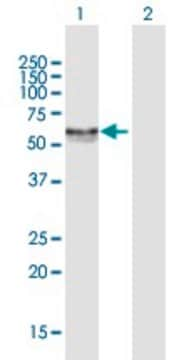 Anti-CA9 antibody produced in mouse purified immunoglobulin, buffered aqueous solution