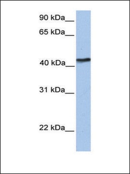 Anti-TMEM149 antibody produced in rabbit affinity isolated antibody