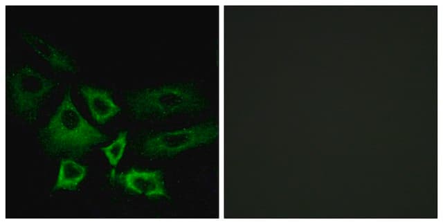 Anti-NT5C1A antibody produced in rabbit affinity isolated antibody