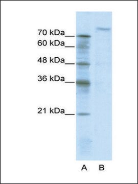 Anti-ZHX2 (AB1) antibody produced in rabbit IgG fraction of antiserum