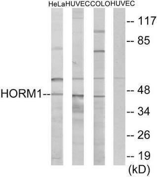 Anti-HORMAD1 antibody produced in rabbit affinity isolated antibody